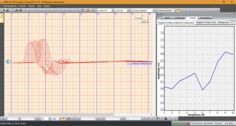 Электронейромиограф M-TEST 2